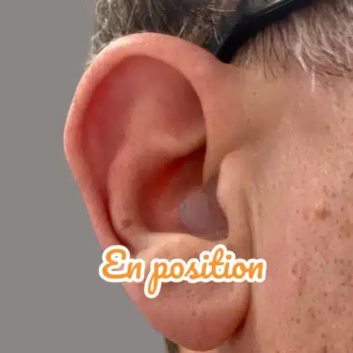 Bouchons d’oreille sur mesure pour dormir – ajustement parfait dans l’oreille pour un sommeil paisible